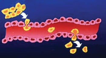 Células cancerosas